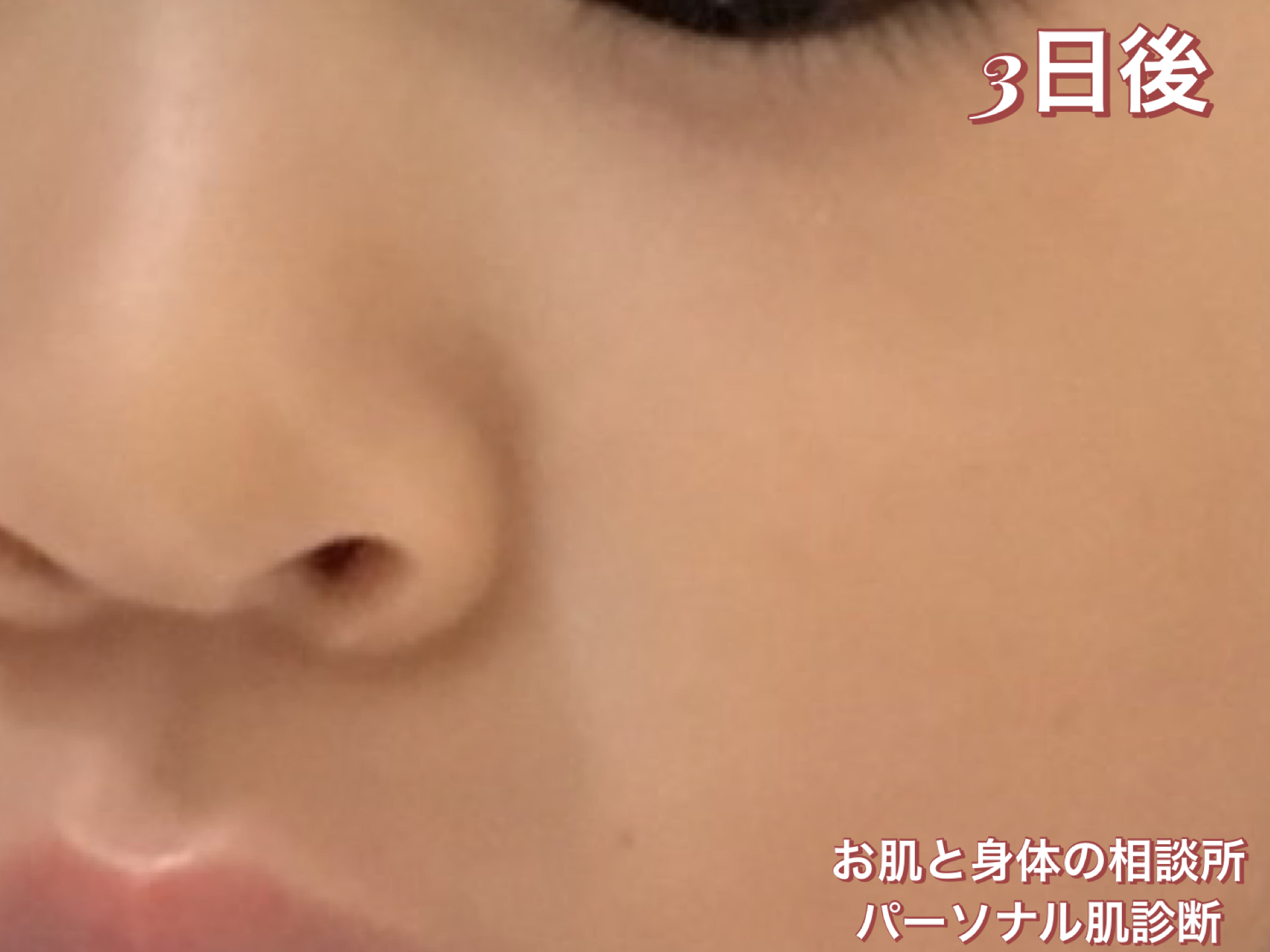 ご相談後に送っていただいたお子さまの肌のお写真