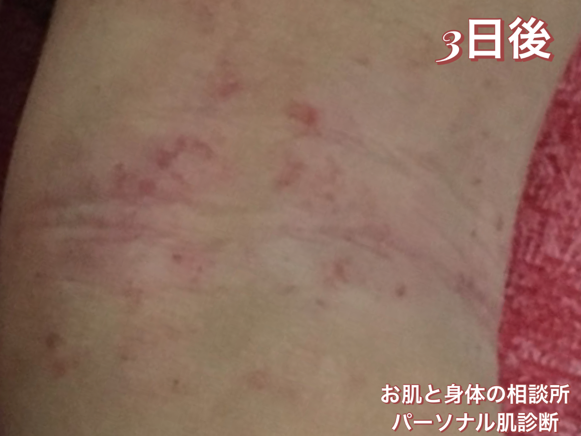お子さまの身体のお手入れ後に送っていただいたお写真